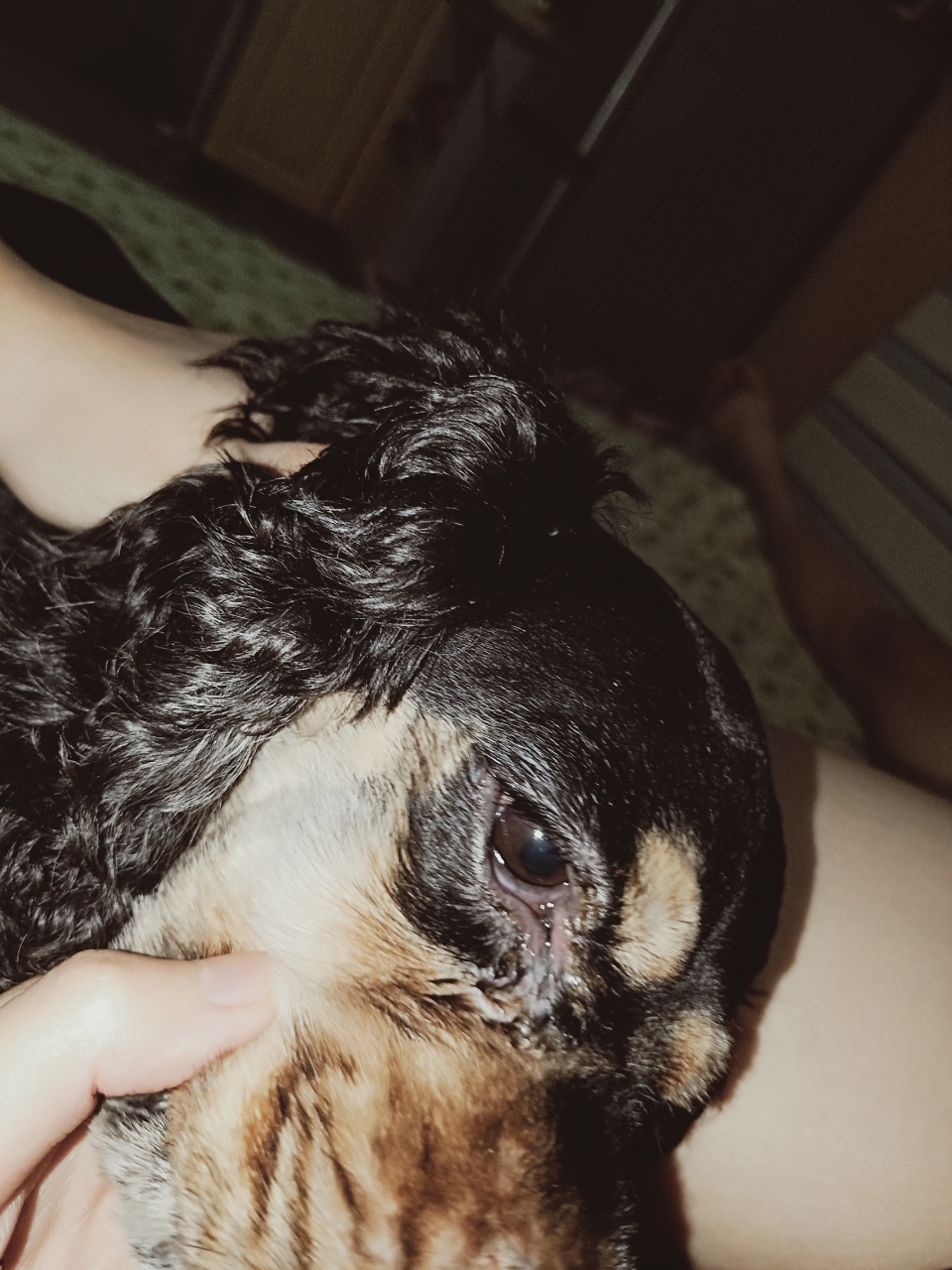 最近一只眼睛红,眼屎也多,下眼睑有点往下边搭