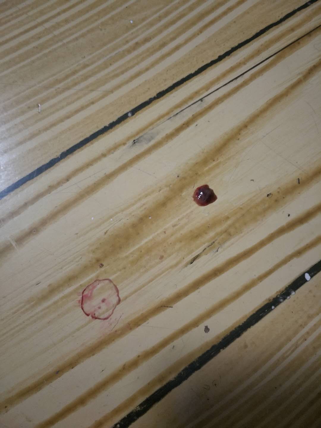 我家泰迪狗狗拉血咋回事