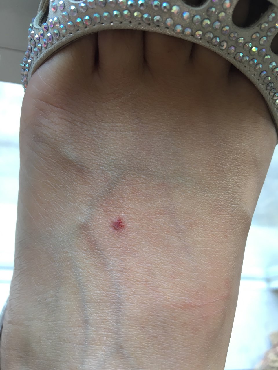 狗狗刚咬的 打了两针疫苗了 过五天该打第三针